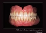 Ref Line - Композитни зъбни гарнитури, цели 