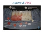 Течна кераника за цирконий Baot Aurora 