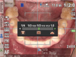Дентален фотоапарат за интраорална фотография EyeSpecial C-V